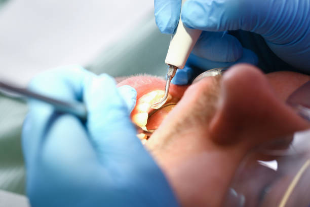 Best Dentist for Tooth Abscess  in South Haven, MI